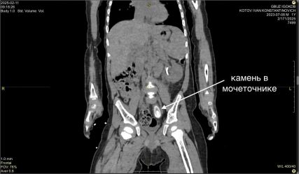 post-22771 thumbnail