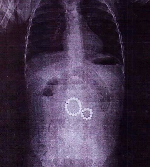 post-28806 thumbnail