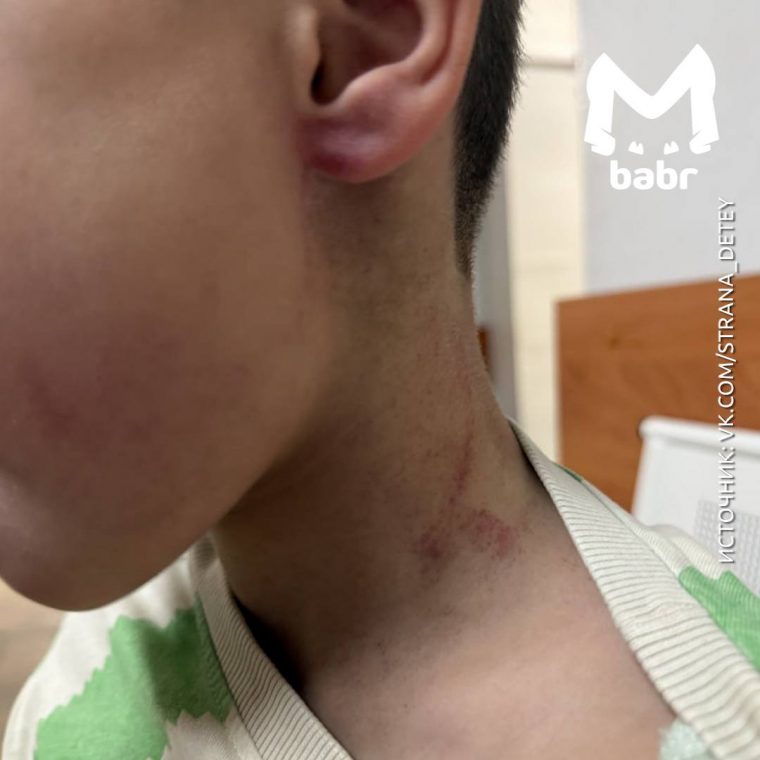 post-32252 thumbnail